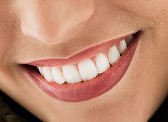 KroMED | Permanent Make-up Hamburg Liplight Lippenkontur und Vollschattierung KroMED | Permanent Make-up Hamburg | Das Bild zeigt ein perfektes Lächeln mit dezent betonten Lippen, die durch Permanent-Make-up professionell verschönert wurden. Besonders auffällig ist die präzise gearbeitete Lippenkontur, die die natürliche Form der Lippen betont. Die feine Schattierung verleiht den Lippen Fülle und Tiefe, ohne künstlich zu wirken. Ein leichter Liplight-Effekt sorgt für zusätzlichen Glanz und hebt die Mitte der Lippen hervor. Diese Technik bringt die Lippen optimal zur Geltung und sorgt für ein harmonisches Gesamtbild. Das Ergebnis wirkt natürlich und elegant, ideal für alle, die einen langanhaltenden, gepflegten Look wünschen. Permanent-Make-up dieser Art bietet nicht nur ästhetische Vorteile, sondern spart auch täglich Zeit bei der Pflege.