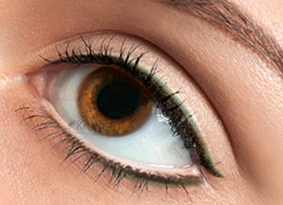 KroMED | Permanent Make-up Augen Lidstrich Kajal KroMED | Permanent Make-up Augen-Lid - farbiger Lidstrich. Sie sind auf der Suche nach einem guten, verantwortungsbewusstem Permanent Make-up Studio, weil Ihre Augenbrauen immer weniger werden? Sie wünschen sich eine schönere Augenbrauenform, mit einem zu Ihrem Gesicht passendem Augenbrauen-Schwung? Dann lassen Sie sich umfassend über neue Techniken einer Augenbrauen-Härchenzeichnung, mit einer ultrafeinen Nano-Nadel oder zu einem Microblading beraten. Sie werden sehen, dass irgendetwas auch für Ihre neue Augenbrauenform, egal ob Härchenzeichnung oder Formschattierung dabei sein wird. Einmal zufrieden und Vertrauen gefasst könnten Sie überschwänglich und mutig werden. Nun möchten Sie auch einen neuen Look für Ihre Augenlider. Aber Sie sind noch unsicher, ob es ein zarter Lidstrich, ein dekorativer, deutlich sichtbarer Lidstrich bis hin zur Möglichkeit von Smokey Eyes werden soll? Ein Tipp: dunkle Oberlider können durch eine dekorative Oberlid-Schattierung oder Lid-Aufhellung einen wunderbaren Glanz erhalten. Besonders Brillenträger profitieren von einem permanenten Eyeliner mit Unterlidstrich. Es gibt viele Möglichkeiten … in jedem Alter und jeder Situation topp auszusehen. KroMED ist Ihr Fachstudio für Medical & Beauty Pigmentation in Hamburg. Lassen Sie sich ausführlich beraten. Wir freuen uns auf Sie. KroMED
