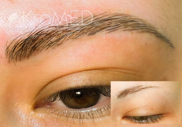 KroMED | Permanent Make-up Augenbrauen Diamant Blading besonders bei Alopecia oder Trichotillomanie KroMED | Permanent Make-up Vorher-Nachher Augenbrauen Härchenzeichnung mit Diamant Blading. In diesem Fall wurde ein fehlender Augenbrauenbogen ergänzt. Die Behandlung eignet sich besonders bei Haarverlust durch Alopecia oder Trichotillomanie. Unsere Spezialisten in Hamburg bieten individuelle Augenbrauenformungen und natürliche Härchenzeichnungen an, um das Erscheinungsbild harmonisch zu gestalten. Perfekt für Menschen, die eine dauerhafte Lösung für lückenhafte oder dünne Augenbrauen suchen.